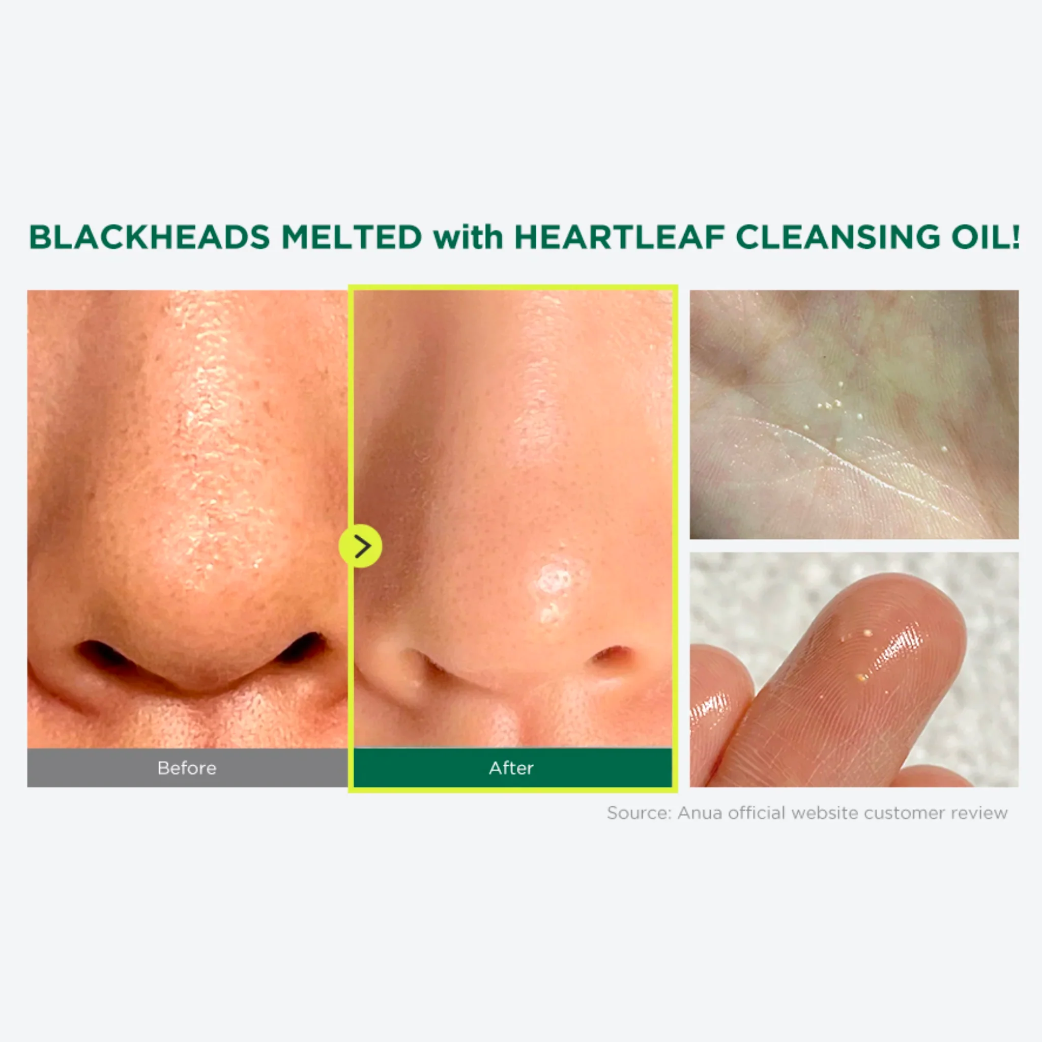 Heartleaf Pore Control Cleansing Oil Mini (20ml) - Image 2